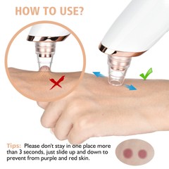 Rechargeable Blackhead Remover Pore Vacuum 5 Suction Deep Cleansing for Unisex