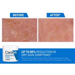 CeraVe Moisturising Cream 50ml – 2 Pack | For Normal to Dry Skin
