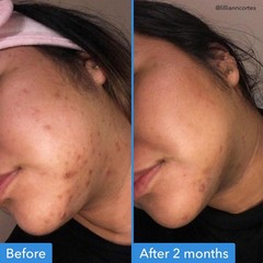 Brightening Discoloration Correcting Serum – Dark Spot Treatment, 1 fl oz