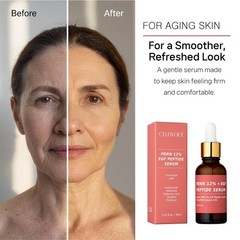 CELDYQUE Salmon DNA PDRN Anti-Aging Serum 1 Fl Oz – Hydrating & Repairing
