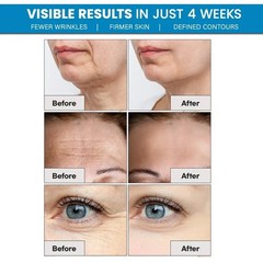 Bee Venom Cream Anti-aging Cream Remove Wrinkles Fine Lines Tightening/Lifting