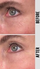 Peptide Collagen Serum AntiAging Wrinkle Cream-Matrixyl 3000 Hyaluronic Acid