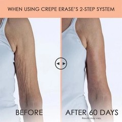 Body Firm Crepe Erase Body Repair Treatment 10 oz