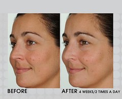 PURE RETINOL VITAMIN A 2.5% + HYALURONIC ACID HA – RETINOL WRINKLE CREAM / SERUM