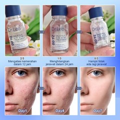2 BOTTLES-Dr.Leo Acne Essence Salicylic Acid Anti-acne Serum Lighten Acne Scars
