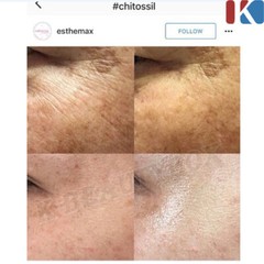 ESTHEMAX Chitossil Thread Lifting Ampoule Set Wrinkles/Lines Care Ampoules NEW