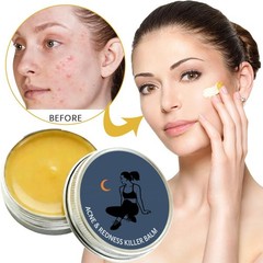 Acne & Redness Killer | Norse Organics Acne- Balm, Ultra-Performance Skincare US