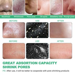 Purifying Acne Peel-off Mask ​Facial Cleansing Blackhead Remover Charcoal Mask