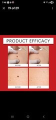 3 Pack Microneedle Botanic Skin Tag and Acne Remover Patches for Skin Tag