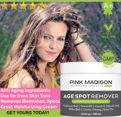 Age Spot Remover Face Body, Hands, Neck. Dark Spot Corrector Cream. Made in USA