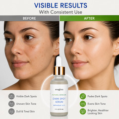 Evagloss Dark Spot Serum with Kojic Acid – Pack of 3 (3 x 1 FL OZ / 30 mL)