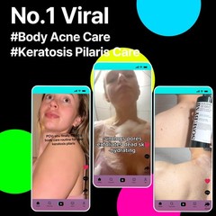 SOME BY MI AHA BHA PHA 30 Days Miracle Acne 13.5 Fl Oz (Pack of 1), Clear
