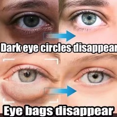 Under Eye Cream Remove Dark Circles Bags Face Lines Wrinkles Ageless Puffy Eye