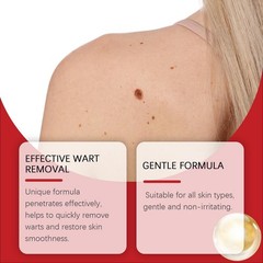 Botanical Microneedles Skin Tag Removal Patch – Quick Acting- 9pcs/Box