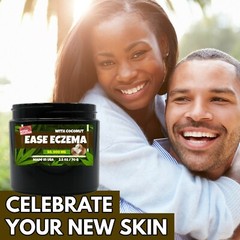 Hempseed Psoriasis Eczema cream, Dermatitis, Dry Skin Care flareups Anti Itch 
