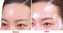 Botulinum-TOX Daily Shot Ampoule, Powered by WRINKLE Eraser Technology (25ml)