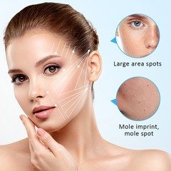 9 Level Laser Plasma Pen Mole Removal Dark Spot Skin Tattoo Wart Tag Remover Pen