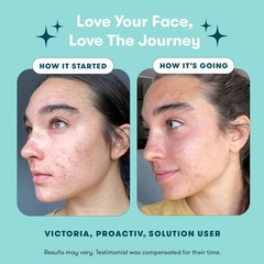 Proactiv 3 Piece Acne Treatment Kit Benzoyl Peroxide Exfoliating Toner exp:2027