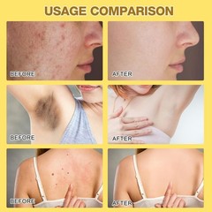 Moisturizing Bee Venom Treatment – Travel-Friendly Cream for All Skin Types