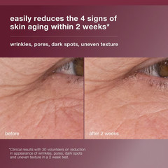 Dermalogica Dynamic Skin Retinol Serum Wrinkle Dark Spot Face Serum