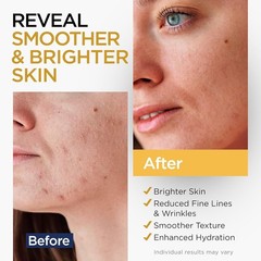 Vitamin C Face Serum Stem Cells Hyaluronic Acid Aloe Vera Vitamin E Anti Aging