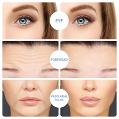 Hyaluronic Acid Microneedle Eye Patches for Anti Wrinkle,Fine Lines Moisturizing