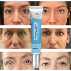 Under Eye Cream Remove Dark Circles Bags Face Lines Wrinkles Ageless Puffy Eye