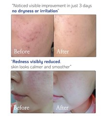 Ceramide Concentrate for Hydration – Mix with Any Moisturizer, Fragrance-Free, L