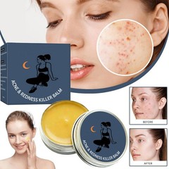 Acne & Redness Killer | Norse Organics Acne- Balm, Ultra-Performance Skincare US