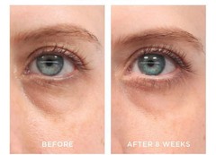 Anti-Aging Retinol Vitamin A 2.5% TURN BACK THE CLOCK Facial Face Serum Cream