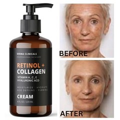 DERMA CLINICALS Retinol + Collagen Anti-Aging Face Cream, Hyaluronic Acid &