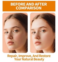 3 Pack Face Serum Set – Vitamin C, Hyaluronic Acid & Retinol – Brightening, Hydr