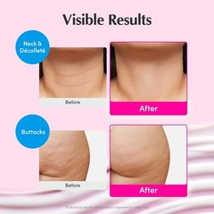 Korean Skincare Firming Neck Cream Set, 1.69 fl.oz x2