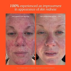 Authentic Tower 28 Daily Hypochlorous Acid Spray for Breakouts Redness,3 SIZES