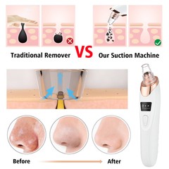 Rechargeable Blackhead Remover Pore Vacuum 5 Suction Deep Cleansing for Unisex