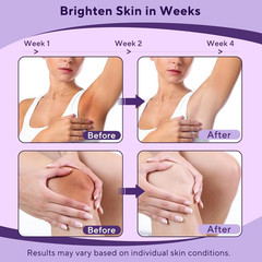 Skin Lightening Cream with Vitamin C for Face Body and Intimate Areas 1.7 Fl Oz