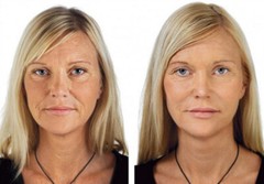 VITAMIN C 30% Facial Serum + HYALURONIC ACID + FERULIC ACID Anti-Aging Gel Cream