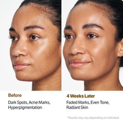SUNGBOON EDITOR Kojic Turmeric Capsule Brightening Cleanser for Uneven Spots, Ac