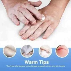 Vitiligo Treatment, Vitiligo Cream Improve Skin Pigmentation & Reduces White …