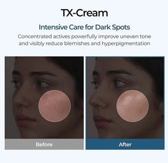 NEW LUXRY DR. Melaxin TX-Cream – Tranexamic Acid + Niacinamide –50ml