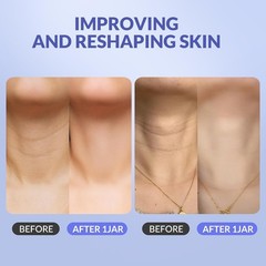 Firming Neck Cream with Hyaluronic Acid & Caffeine – 1.7 fl. oz, All Skin Types