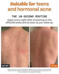 Norse Organics Body Balm Acne Prone Skin Arctic Herbs Beeswax 1.7 oz