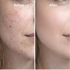 Copper Peptide formula GHK-Cu Hyaluronic Acid Face Tightening 30ml