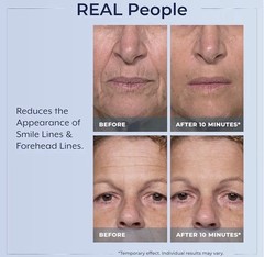 Plexaderm Rapid Reduction Serum