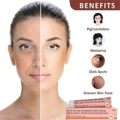 2 NG Glow Cream 20gm Each For Melasma , Pigmentation , Acne Scar Dark Spot