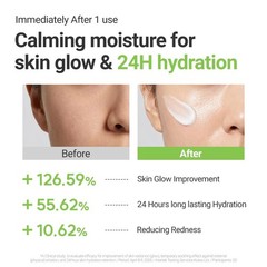 Calming Lotus Cream – Lightweight Hydrating & Soothing Moisturizer Face Cream…